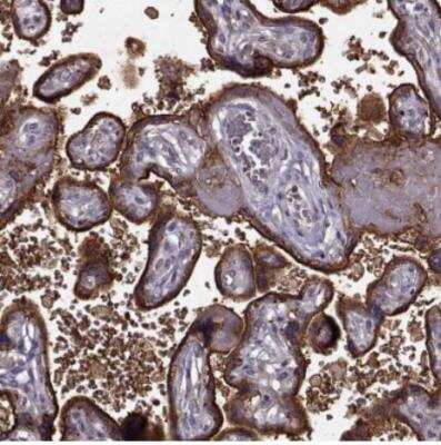 Immunohistochemistry-Paraffin: YIPF5 Antibody [NBP2-57970]