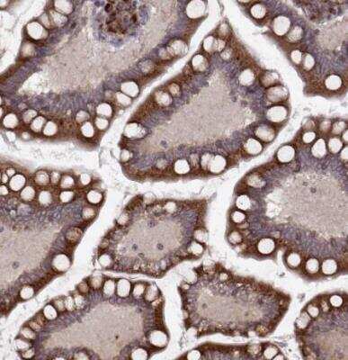 Immunohistochemistry-Paraffin: YIPF5 Antibody [NBP2-57970]