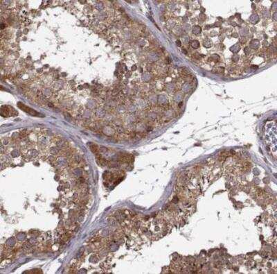 Immunohistochemistry-Paraffin: YIPF5 Antibody [NBP2-57970]