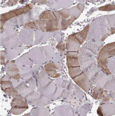 Immunohistochemistry-Paraffin: YIPF5 Antibody [NBP2-57970]