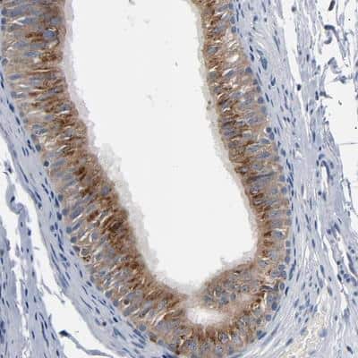 Immunohistochemistry-Paraffin: YIPF6 Antibody [NBP1-90457]