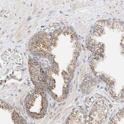 Immunohistochemistry: YIPF7 Antibody [NBP1-90456]