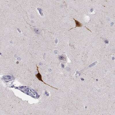 Immunohistochemistry-Paraffin: YJEFN3 Antibody [NBP2-32568]
