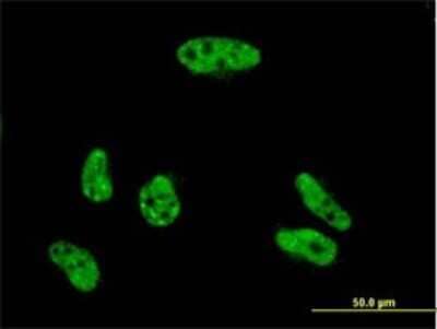 Immunocytochemistry/ Immunofluorescence: YL1 Antibody (2G6) [H00006944-M01]