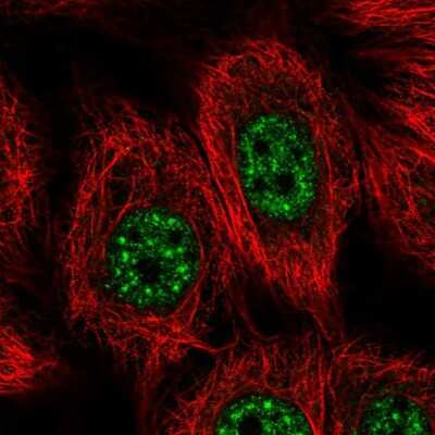 Immunocytochemistry/ Immunofluorescence: YL1 Antibody [NBP2-56002]