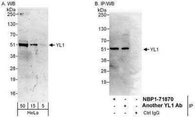 Western Blot: YL1 Antibody [NBP1-71870]