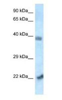 Western Blot: YL1 Antibody [NBP1-82385]