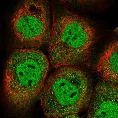 Immunocytochemistry/ Immunofluorescence: YLPM1 Antibody [NBP2-14628]