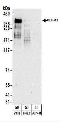 Western Blot: YLPM1 Antibody [NBP2-22326]