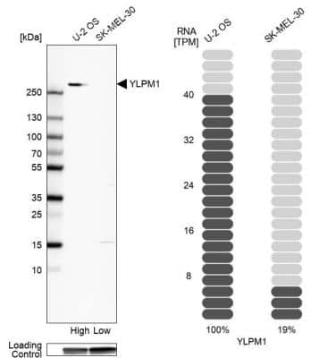 Western Blot: YLPM1 Antibody [NBP2-56737]