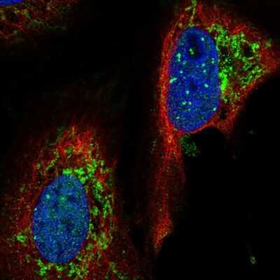 Immunocytochemistry/ Immunofluorescence: YME1L1 Antibody [NBP2-49499]