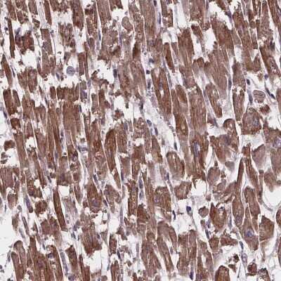 Immunohistochemistry-Paraffin: YME1L1 Antibody [NBP2-49499]