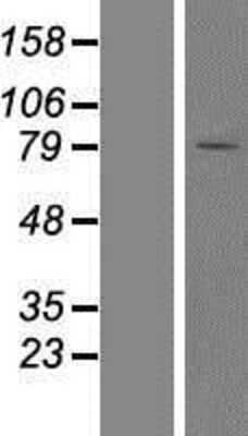 Western Blot: YME1L1 Overexpression Lysate [NBP2-05579]