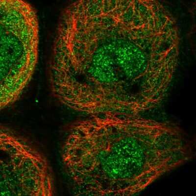 Immunocytochemistry/ Immunofluorescence: YOD1 Antibody [NBP1-84172]