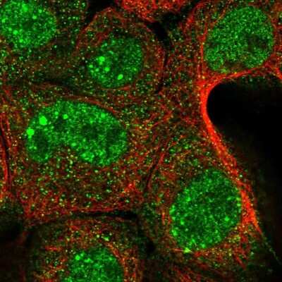Immunocytochemistry/ Immunofluorescence: YOD1 Antibody [NBP1-84173]
