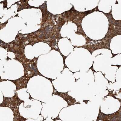 Immunohistochemistry-Paraffin: YOD1 Antibody [NBP1-84173]