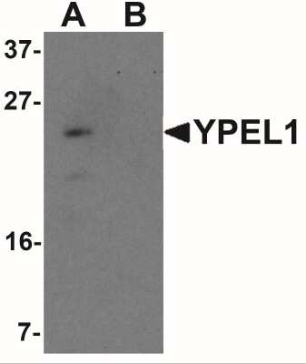 Western Blot: YPEL1 AntibodyBSA Free [NBP2-41163]