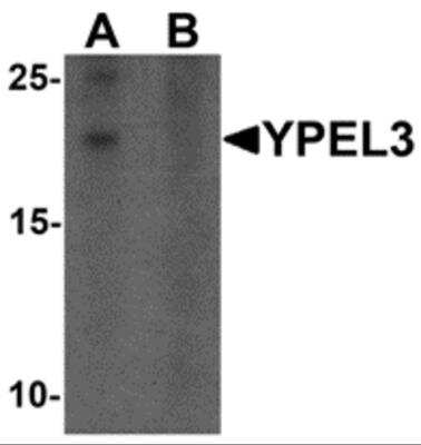 Western Blot: YPEL3 AntibodyBSA Free [NBP2-81867]