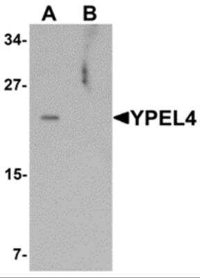 Western Blot: YPEL4 AntibodyBSA Free [NBP2-81957]