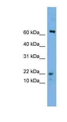 Western Blot: YPEL5 Antibody [NBP1-79644]