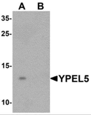 Western Blot: YPEL5 AntibodyBSA Free [NBP2-82063]