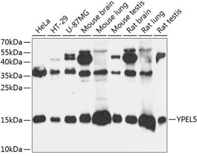 Western Blot: YPEL5 AntibodyAzide and BSA Free [NBP2-93289]