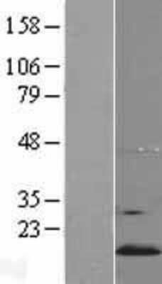 Western Blot: YPEL5 Overexpression Lysate [NBL1-17941]