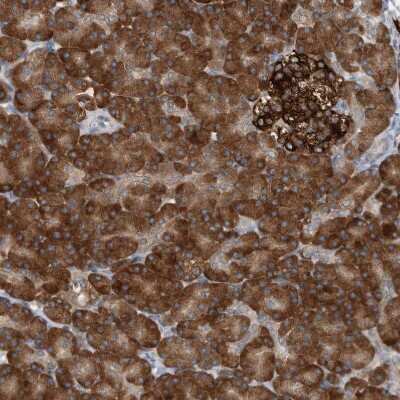 Immunohistochemistry-Paraffin: YRDC Antibody [NBP1-82072]