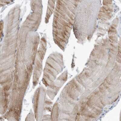 Immunohistochemistry-Paraffin: YRDC Antibody [NBP1-82072]