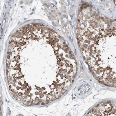 Immunohistochemistry-Paraffin: YRDC Antibody [NBP1-82072]