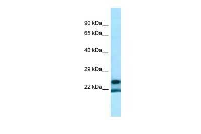 Western Blot: YRDC Antibody [NBP2-83779]