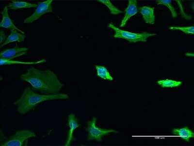 Immunocytochemistry/ Immunofluorescence: YSK4 Antibody (2A4) [H00080122-M01]