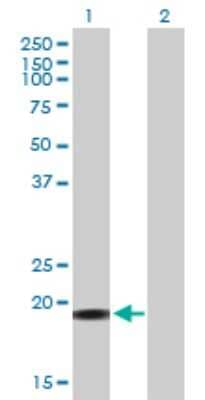 Western Blot: YSK4 Antibody [H00080122-B01P]