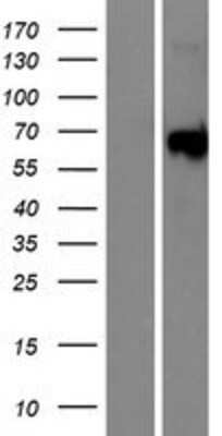 Western Blot: YSK4 Overexpression Lysate [NBP2-08673]