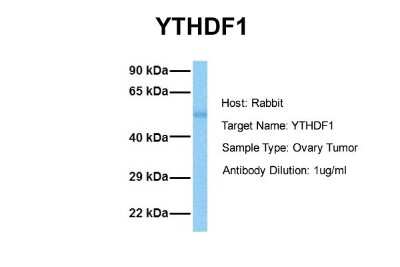 Western Blot: YTHD1 Antibody [NBP1-52865]