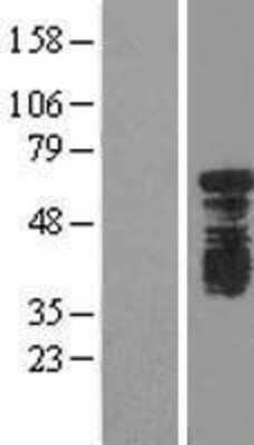 Western Blot: YTHD1 Overexpression Lysate [NBL1-17943]