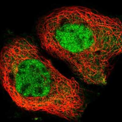 Immunocytochemistry/ Immunofluorescence: YTHDC1 Antibody [NBP1-81353]