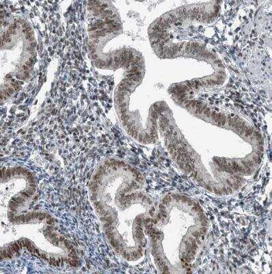 Immunohistochemistry-Paraffin: YTHDC1 Antibody [NBP1-81353]