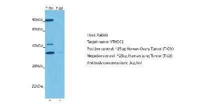 Western Blot: YTHDC1 Antibody [NBP2-83780]