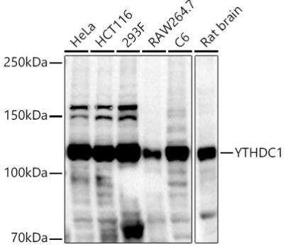 Western Blot: YTHDC1 AntibodyAzide and BSA Free [NBP2-93050]