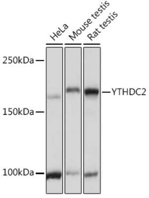 Western Blot: YTHDC2 AntibodyAzide and BSA Free [NBP2-95159]