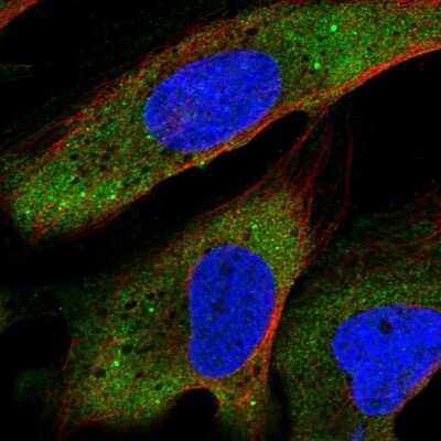 Immunocytochemistry/ Immunofluorescence: YTHDF2 Antibody [NBP2-68614]