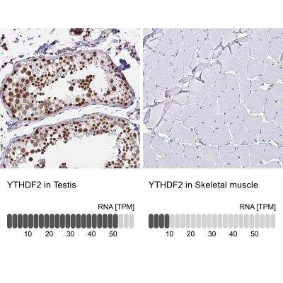 Immunohistochemistry-Paraffin: YTHDF2 Antibody [NBP2-31785]