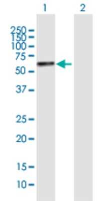 Western Blot: YTHDF2 Antibody [H00051441-B01P]