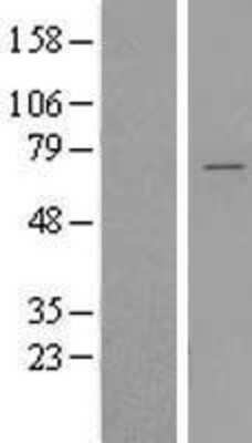 Western Blot: YTHDF2 Overexpression Lysate [NBL1-17944]