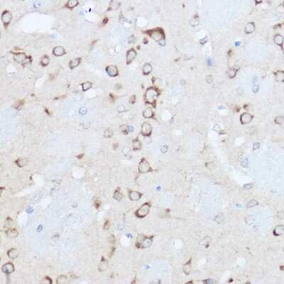 Immunohistochemistry-Paraffin: YTHDF3 Antibody - BSA Free [NBP2-94636]