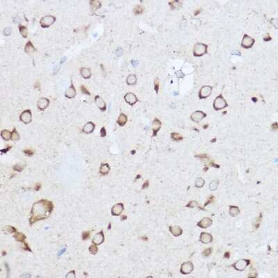 Immunohistochemistry-Paraffin: YTHDF3 Antibody - BSA Free [NBP2-94636]
