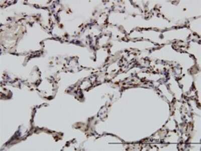 Immunohistochemistry-Paraffin: YY1 Antibody (2C4) [H00007528-M01]