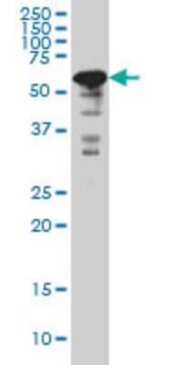 Western Blot: YY1 Antibody (2C5) [H00007528-M04]