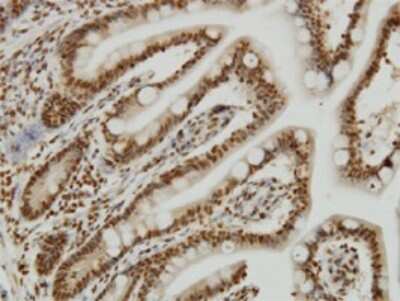 Immunohistochemistry-Paraffin: YY1 Antibody (4A5) [H00007528-M02]